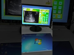 Σταθερή πηγή κύματος εξωσωματικό κύμα σοκ μηχανή λιθοτριψίας σύστημα εντοπισμού υπερήχων