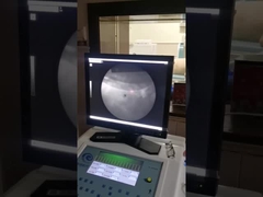 Υψηλής ακρίβειας εξωσωματική μηχανή για τα κύματα σοκ, σύστημα ακτινογραφίας Λιθοριψίας.