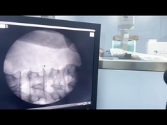 Υψηλής συχνότητας εξωσωματική μηχανή ωθητικών κυμάτων με εστιαστικό εφαρμοστή 1-16Hz 100W